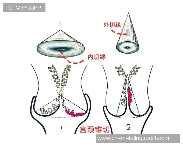 内切vs外切的全面对比分析与应用场景探讨
